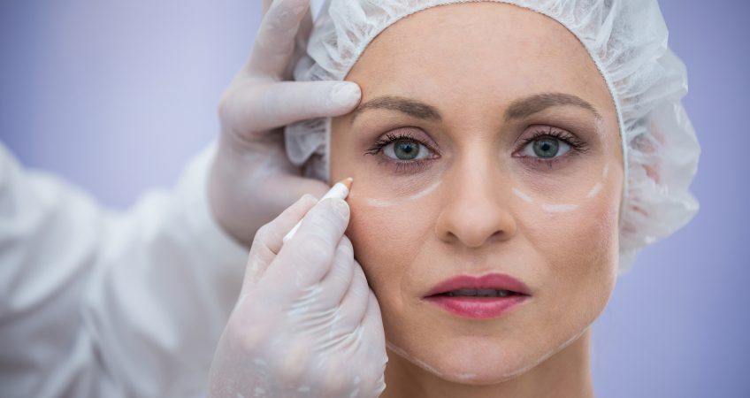 Plastic Surgery Fails - How To Make A Medical Negligence Claim? - United  Legal