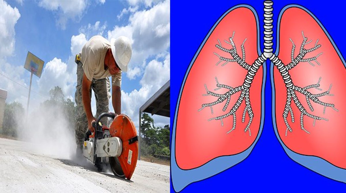 Silicosis, Asutralia